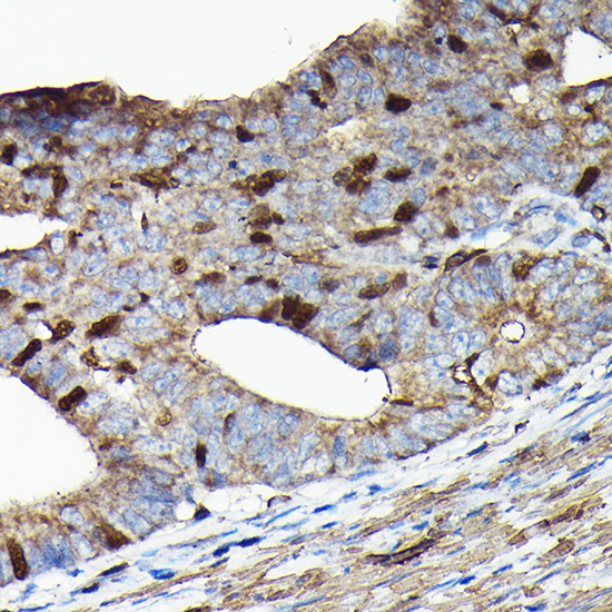 Anti-PRC1 Antibody (CAB7029)