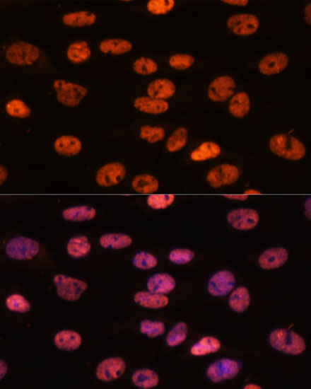 Anti-MYEF2 Antibody (CAB15829)