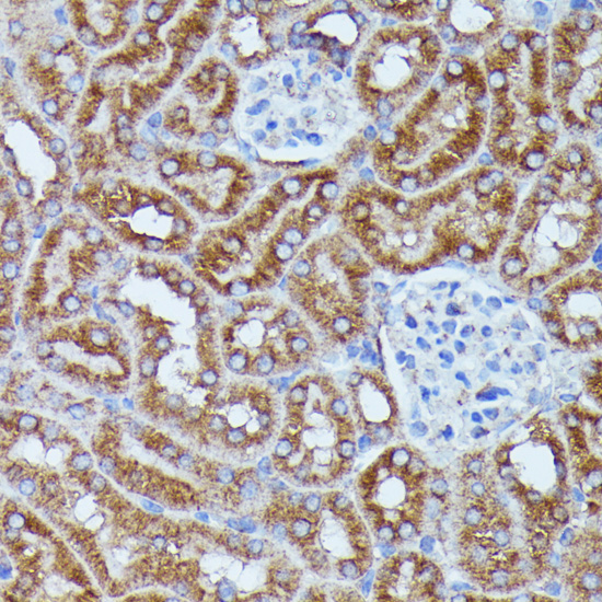 Anti-DDX6 Antibody (CAB16270)