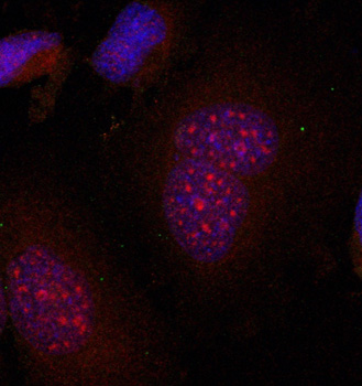 Anti-Phospho-JUNB-S79 Antibody (CABP0376)