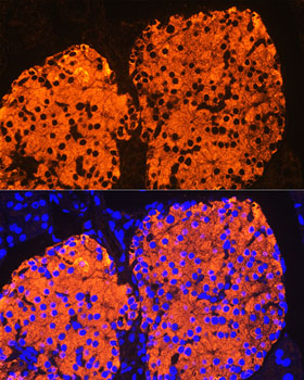 Anti-Insulin Antibody (CAB2090)