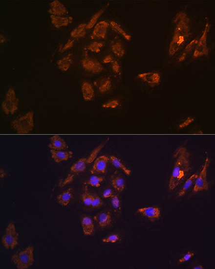 Anti-TRH Antibody (CAB14472)