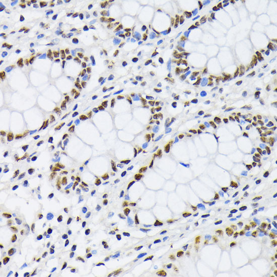 Anti-PTBP1 Antibody (CAB1831)