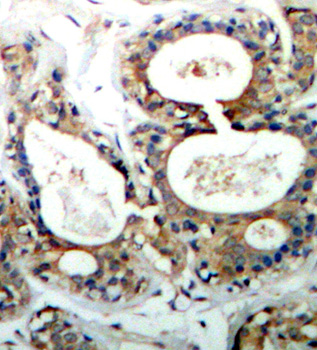 Anti-Phospho-PTPN11-Y542 Antibody (CABP0267)