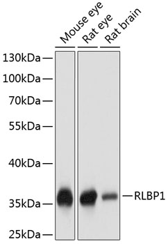 Anti-RLBP1 Polyclonal Antibody (CAB9094)