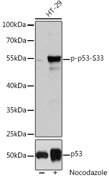 Anti-Phospho-TP53-S33 pAb (CABP0762)