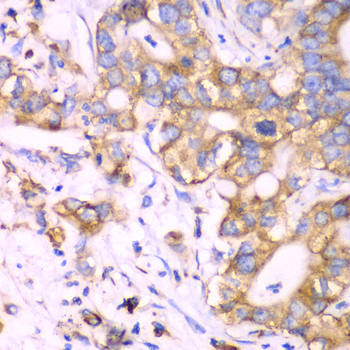 Anti-RPS3A Antibody (CAB5885)