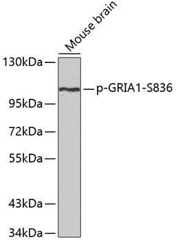 Anti-Phospho-GRIA1-S836 Antibody (CABP0356)