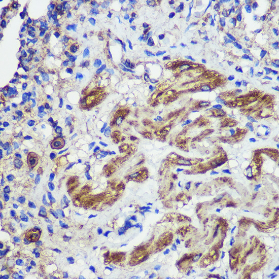 Anti-SND1 Antibody [KO Validated] (CAB5874)