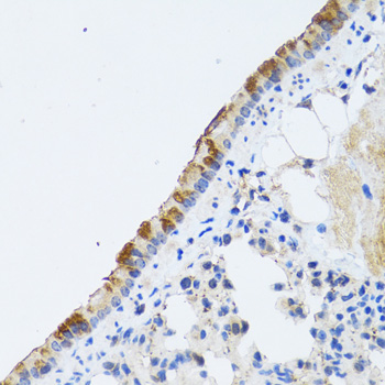 Anti-ST3GAL3 Antibody (CAB6753)