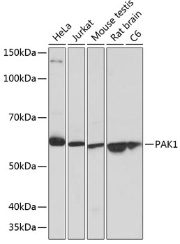 Anti-PAK1 Antibody (CAB19608)