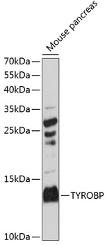 Anti-TYROBP Antibody (CAB14794)