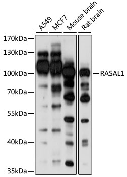 Anti-RASAL1 Antibody (CAB15114)