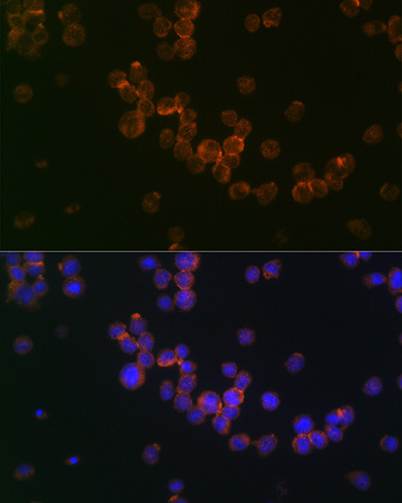 Anti-CD68 Antibody (CAB13286)
