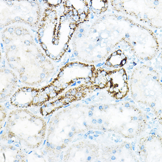 Anti-BCAT2 Antibody (CAB7426)