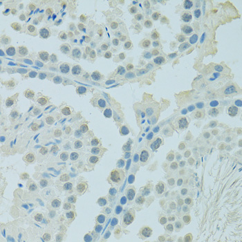 Anti-PSIP1 Antibody (CAB14852)