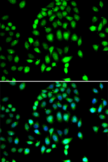 Anti-PARP3 Antibody (CAB7297)