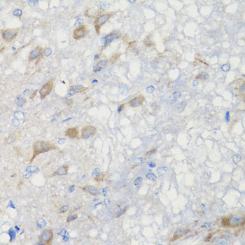 Anti-CHIC2 Polyclonal Antibody (CAB7971)