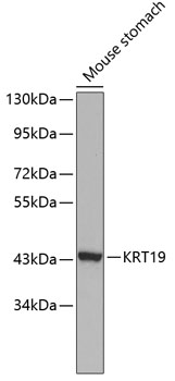 Anti-KRT19 Antibody (CAB0247)