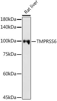 Western blot analysis of extracts of Rat liver, using TMPRSS6 antibody at 1:1000 dilution. Secondary antibody: HRP Goat Anti-Rabbit IgG (H+L) at 1:10000 dilution. Lysates/proteins: 25ug per lane. Blocking buffer: 3% nonfat dry milk in TBST. Detection: ECL Basic Kit. Exposure time: 180s.