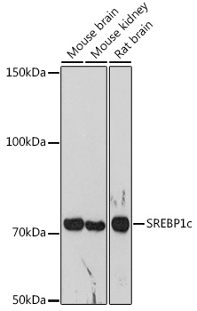 Anti-SREBP1c Antibody (CAB15586)