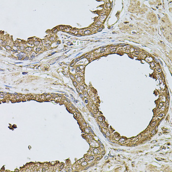 Anti-ANXA8L2 Antibody (CAB7641)