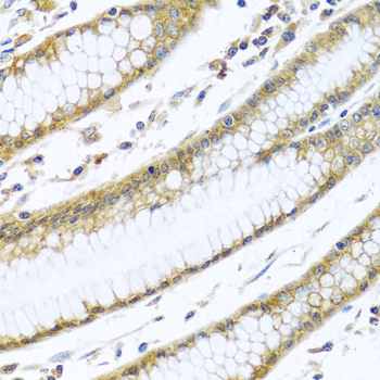 Anti-GNAI3 Antibody (CAB1922)