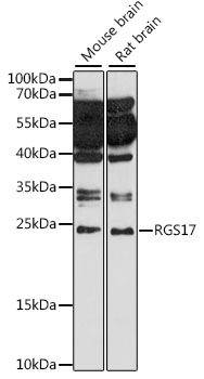 Anti-RGS17 Antibody (CAB15815)