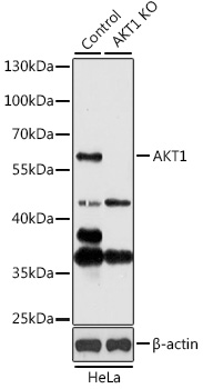 Anti-AKT1 Antibody [KO Validated] (CAB16343)