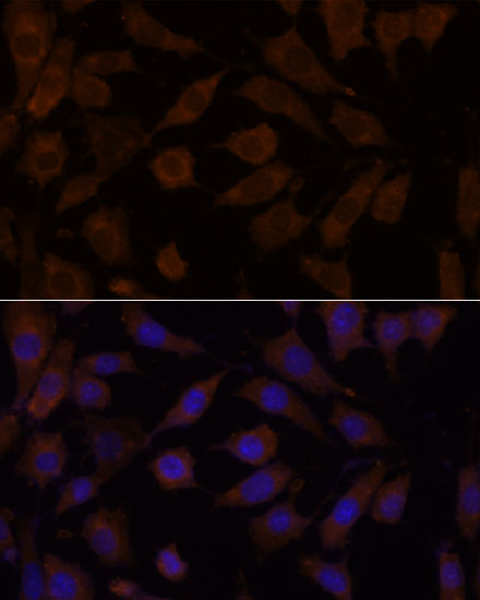 Anti-OXSR1 Antibody (CAB15126)