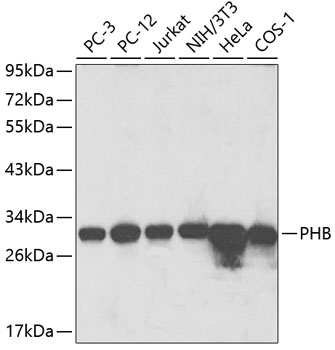 Anti-PHB Antibody (CAB13526)