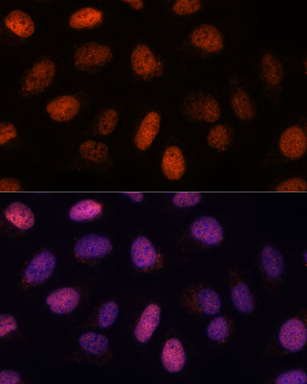 Anti-RPP38 Antibody (CAB17080)