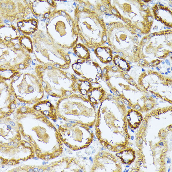 Anti-MT-CO3 Antibody (CAB18318)