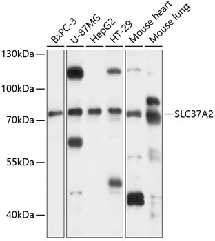 Anti-SLC37A2 Antibody (CAB14459)