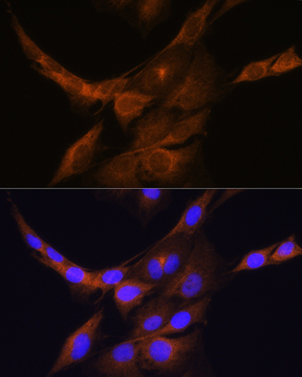 Anti-PHOSPHO2 Antibody (CAB12816)