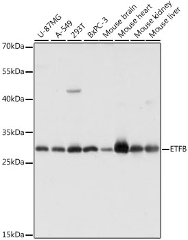 Anti-ETFB Antibody (CAB16043)