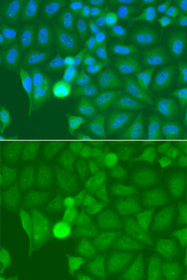 Anti-IRAK2 Antibody (CAB6635)