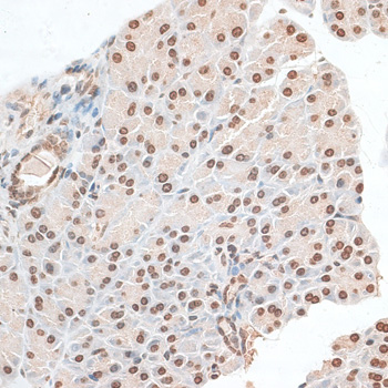 Anti-ZNF177 Antibody (CAB14802)