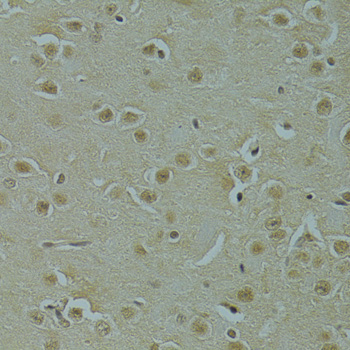 Anti-RSRC1 Antibody (CAB7210)