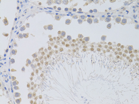 Anti-PHC1 Antibody (CAB5843)