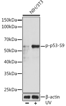 Anti-Phospho-p53-S9 Antibody (CABP0985)