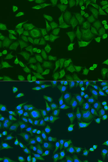 Anti-RPS27A Antibody (CAB2027)