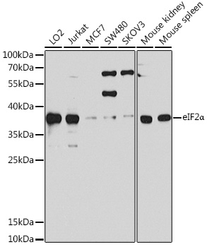 Anti-eIF2Alpha Antibody (CAB0764)