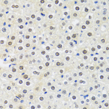 Anti-MTAP Antibody (CAB1049)