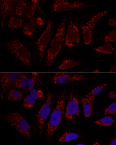 Anti-CHCHD3 Polyclonal Antibody (CAB8584)