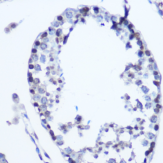 Anti-MSH6 Antibody (CAB0983)