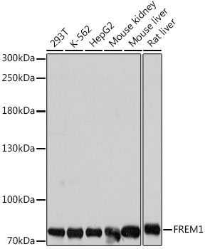 Anti-FREM1 Antibody (CAB16603)