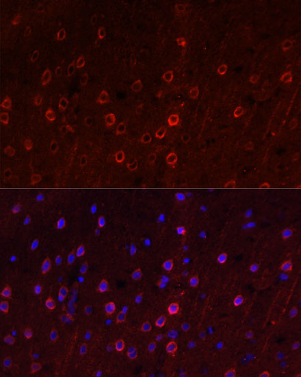 Anti-SLC1A1 Antibody (CAB2903)