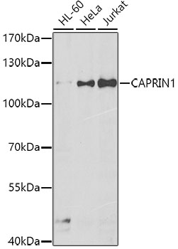 Anti-CAPRIN1 Antibody (CAB7910)