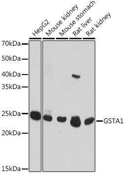 Anti-GSTA1 Antibody (CAB18266)